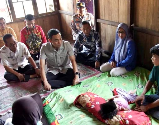 Haru di Ulak Depati: Kisah Ruqhayah, Balita Pejuang Atresia Ani yang Dapat Dukungan Langsung Bupati OKI