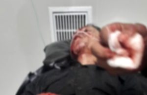 Sadis! Sales Telkomsel Dibegal di Banyuasin, Alami Luka Parah Disabet Sajam